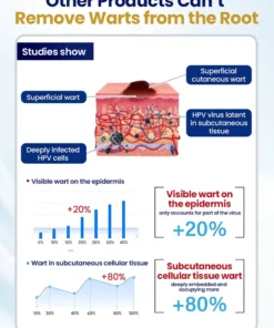 NESLEMY® ChillErase Bump Renewal Spray