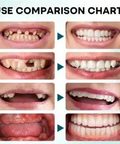 NESLEMY® FirmHold Denture Adhesive