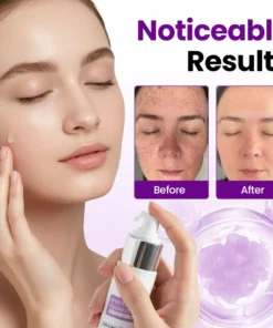 NESLEMY® SpotErase Probiotic Shield Serum