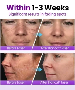 NESLEMY® SpotErase Probiotic Shield Serum