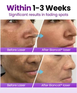 NESLEMY® SpotErase Probiotic Shield Serum