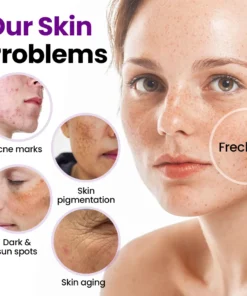 NESLEMY® SpotErase Probiotic Shield Serum