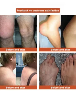 NESLEMY™:New upgrade 2.0:Herbal All-in-One Pain Relief Patch