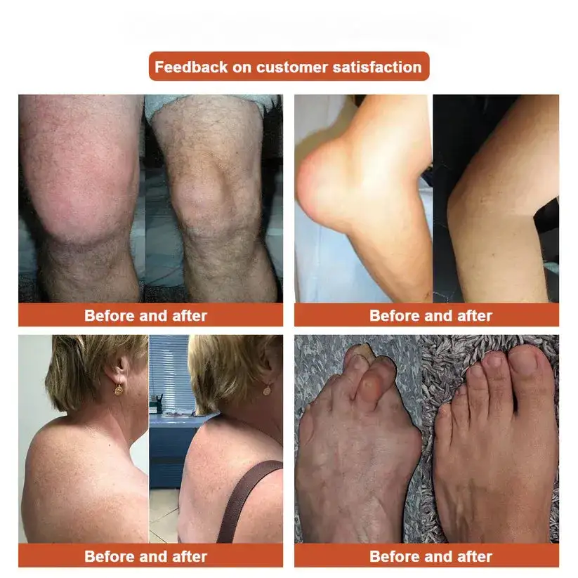 NESLEMY™:New upgrade 2.0:Herbal All-in-One Pain Relief Patch