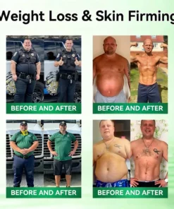 NESLEMY ®𝑴𝒐𝒓𝒊𝒏𝒈𝒂 & 𝑩𝒆𝒓𝒃𝒆𝒓𝒊𝒏𝒆 20-𝑰𝑵-1 𝑨𝒅𝒗𝒂𝒏𝒄𝒆𝒅 𝑵𝒂𝒏𝒐 𝑴𝒊𝒄𝒓𝒐𝒏𝒆𝒆𝒅𝒍𝒆 𝑷𝒂𝒕𝒄𝒉