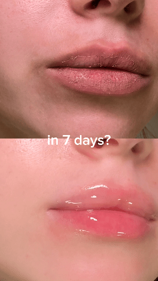 NESLEMY® Peptide Nourishing Brightening Lip Serum