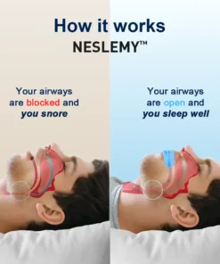 NESLEMY™ Professional intelligent anti-snoring device, an efficient anti-snoring solution suitable for all people, helping you regain peaceful sleep