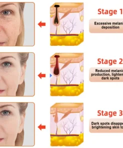 NESLEMY™ Purifying Exfoliating Gel for Acanthosis Nigricans, Exfoliation, Dark Spots, Skin Tags, and Eczema