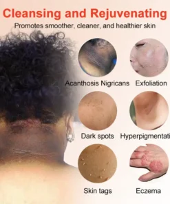NESLEMY™ Purifying Exfoliating Gel for Acanthosis Nigricans, Exfoliation, Dark Spots, Skin Tags, and Eczema