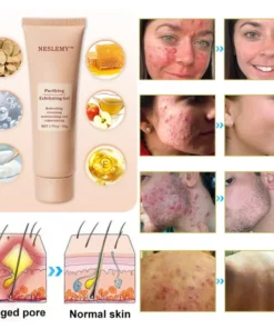 NESLEMY™ Purifying Exfoliating Gel for Acanthosis Nigricans, Exfoliation, Dark Spots, Skin Tags, and Eczema