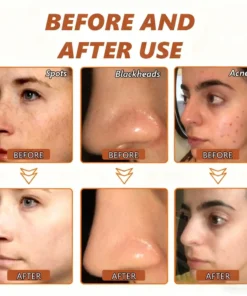 NESLEMY™ Whitening and Spot-Removing Face Mask Suitable for face and body