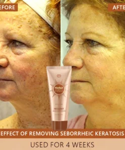 NESLEMY™ Whitening and Spot-Removing Face Mask Suitable for face and body