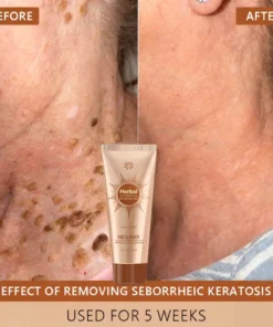 NESLEMY™ Whitening and Spot-Removing Face Mask Suitable for face and body