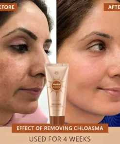 NESLEMY™ Whitening and Spot-Removing Face Mask Suitable for face and body