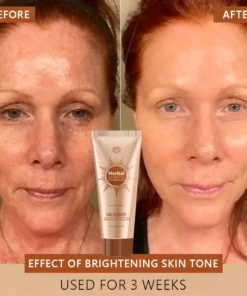 NESLEMY™ Whitening and Spot-Removing Face Mask Suitable for face and body