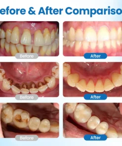 NESLEMY™ NanoHAP Tooth Defense Serum