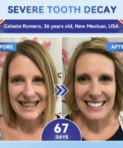 NESLEMY® Tideglusib Fast‑Dissolving Tooth & Gum Repair Oral Strips