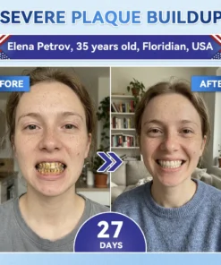 NESLEMY® Tideglusib Fast‑Dissolving Tooth & Gum Repair Oral Strips