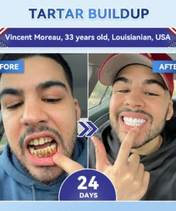 NESLEMY® Tideglusib Fast‑Dissolving Tooth & Gum Repair Oral Strips