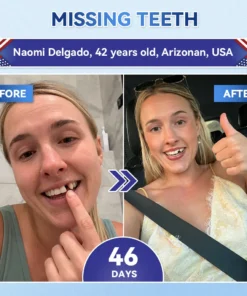 NESLEMY® Tideglusib Fast‑Dissolving Tooth & Gum Repair Oral Strips