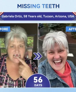 NESLEMY® Tideglusib Fast‑Dissolving Tooth & Gum Repair Oral Strips