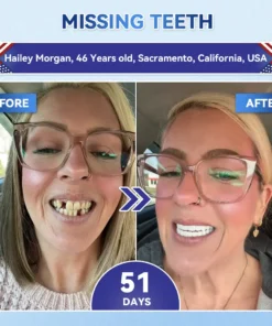 NESLEMY® Tideglusib Fast‑Dissolving Tooth & Gum Repair Oral Strips