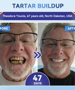 NESLEMY® Tideglusib Fast‑Dissolving Tooth & Gum Repair Oral Strips