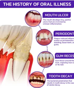 NESLEMY® Bee Venom Dental Treatment Toothpaste
