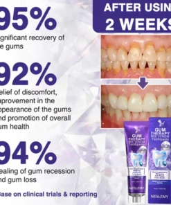 NESLEMY® Bee Venom Dental Treatment Toothpaste