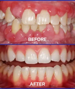 NESLEMY® Bee Venom Dental Treatment Toothpaste