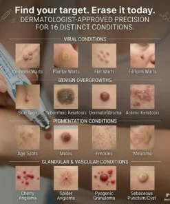 NESLEMY® 7-Day Skin Tag & Spot Eraser Painless & Scar-Free Advanced Imperfection Removal Rollerball Pen