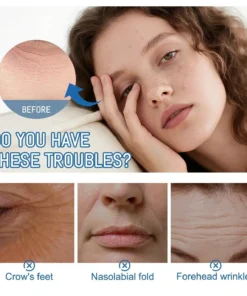 NESLEMY™ Instant Face Temporary Tightener