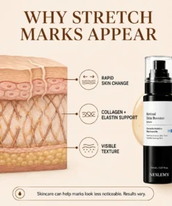 NESLEMY Advanced Retinal Stretch Mark Serum