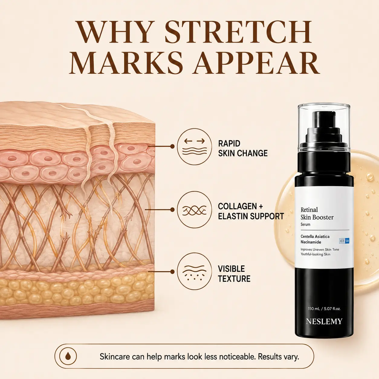 NESLEMY Advanced Retinal Stretch Mark Serum