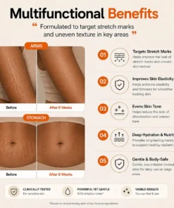 NESLEMY Advanced Retinal Stretch Mark Serum