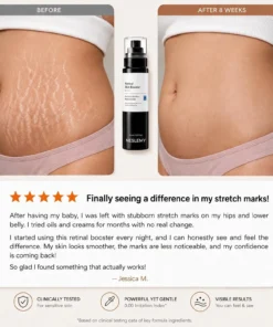 NESLEMY Advanced Retinal Stretch Mark Serum