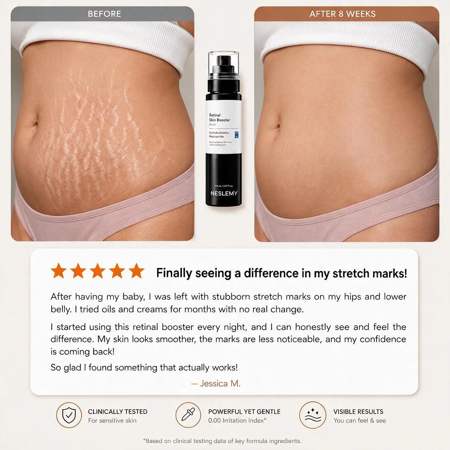 NESLEMY Advanced Retinal Stretch Mark Serum