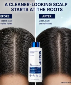 NESLEMY Folliculitis Shampoo for Itchy, Flaky & Oily Scalp