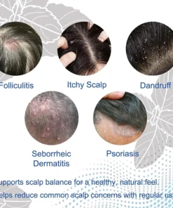 NESLEMY Folliculitis Shampoo for Itchy, Flaky & Oily Scalp