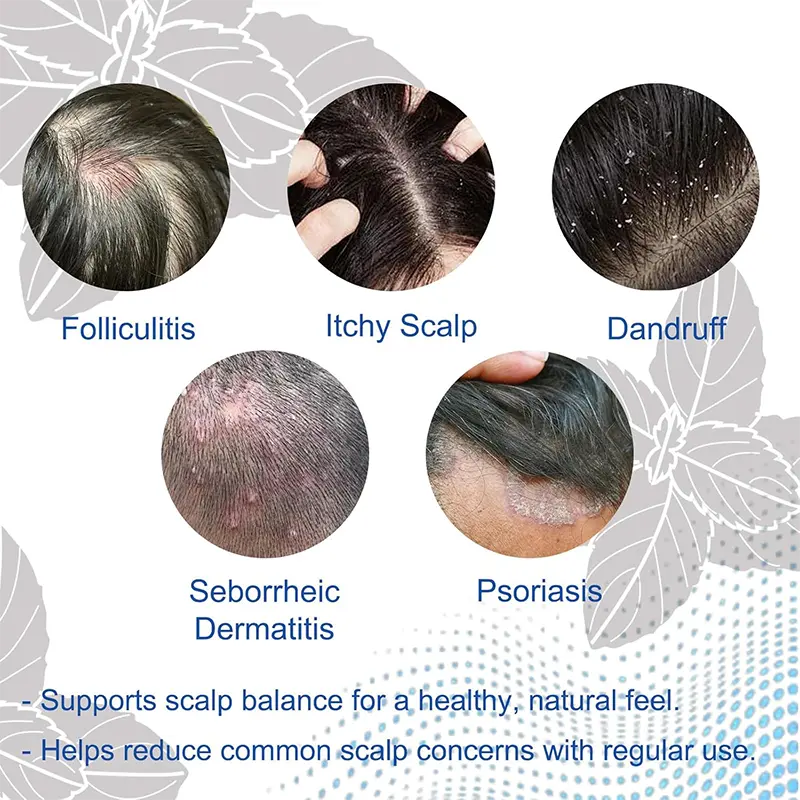 NESLEMY Folliculitis Shampoo for Itchy, Flaky & Oily Scalp