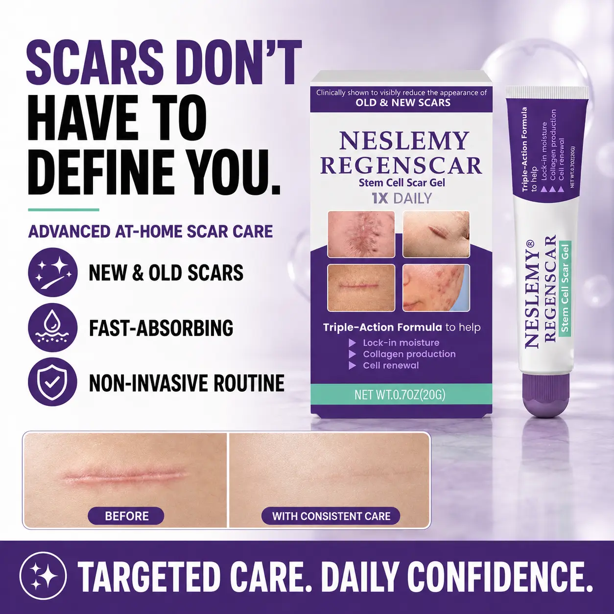 NESLEMY® ReGenScar Stem Cell Scar Gel