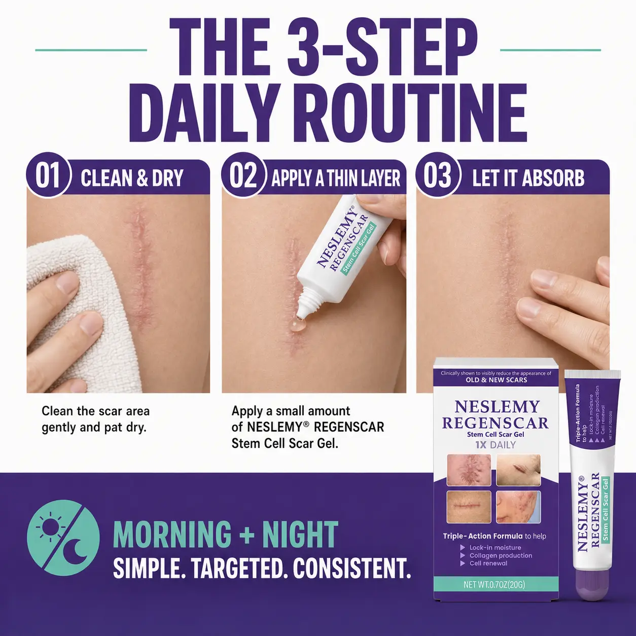 NESLEMY® ReGenScar Stem Cell Scar Gel