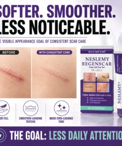 NESLEMY® Scar Gel