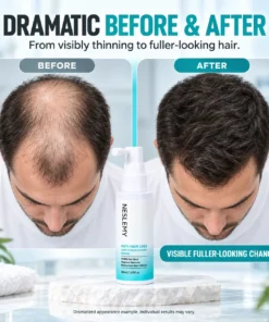 NESLEMY® 5% Minoxidil Hair Regrowth Treatment
