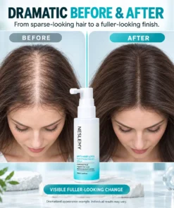 NESLEMY® 5% Minoxidil Hair Regrowth Treatment